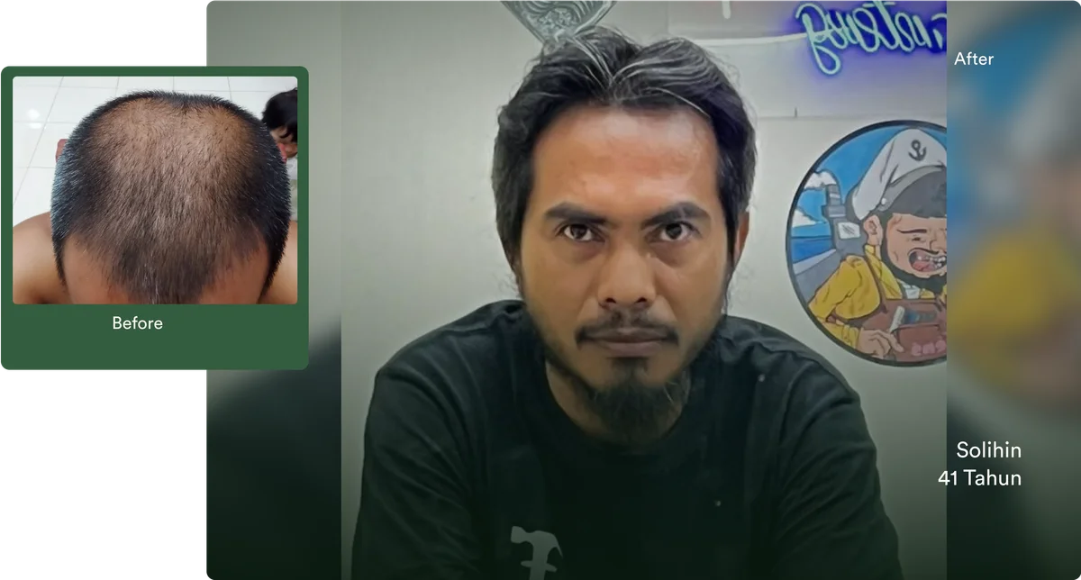 Cerita perjalanan treatment Bro Solihin